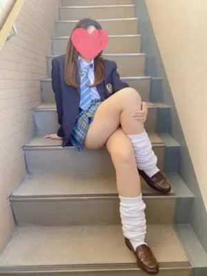 MIO